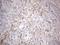Platelet Derived Growth Factor Receptor Alpha antibody, NBP2-46357, Novus Biologicals, Immunohistochemistry paraffin image 