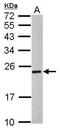 Charged Multivesicular Body Protein 4C antibody, PA5-32050, Invitrogen Antibodies, Western Blot image 