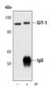 GIT ArfGAP 1 antibody, PA5-17246, Invitrogen Antibodies, Immunoprecipitation image 