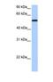 UDP Glucuronosyltransferase Family 2 Member A3 antibody, NBP1-69358, Novus Biologicals, Western Blot image 