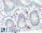 CD40 Ligand antibody, LS-B11325, Lifespan Biosciences, Immunohistochemistry paraffin image 