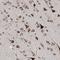 Endoplasmic Reticulum Lectin 1 antibody, HPA031502, Atlas Antibodies, Immunohistochemistry paraffin image 