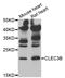 C-Type Lectin Domain Family 3 Member B antibody, A08805-1, Boster Biological Technology, Western Blot image 