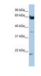 Homeobox And Leucine Zipper Encoding antibody, NBP1-79253, Novus Biologicals, Western Blot image 