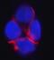 Catenin Delta 1 antibody, M02333-2, Boster Biological Technology, Immunofluorescence image 