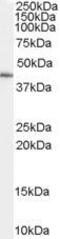 GATA Binding Protein 5 antibody, GTX89189, GeneTex, Western Blot image 