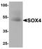 SRY-Box 4 antibody, PA5-72852, Invitrogen Antibodies, Western Blot image 