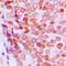 p21 antibody, GTX32376, GeneTex, Immunohistochemistry paraffin image 