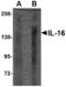 Interleukin 16 antibody, LS-C82914, Lifespan Biosciences, Western Blot image 