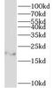  antibody, FNab04114, FineTest, Western Blot image 