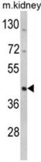 WD Repeat And SOCS Box Containing 2 antibody, AP17836PU-N, Origene, Western Blot image 