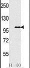 Inositol Polyphosphate-5-Phosphatase D antibody, PA5-12463, Invitrogen Antibodies, Western Blot image 