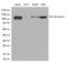Insulin Like Growth Factor 1 Receptor antibody, M00070-1, Boster Biological Technology, Western Blot image 