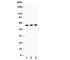 Cytochrome P450 Family 11 Subfamily A Member 1 antibody, R30785, NSJ Bioreagents, Western Blot image 