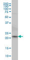 NFKB Inhibitor Interacting Ras Like 2 antibody, LS-C133732, Lifespan Biosciences, Western Blot image 