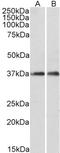 Actin Related Protein 2/3 Complex Subunit 1A antibody, LS-B9553, Lifespan Biosciences, Western Blot image 