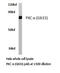 Protein Kinase C Alpha antibody, LS-C176452, Lifespan Biosciences, Western Blot image 