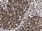 DNA Methyltransferase 3 Alpha antibody, NBP1-85961, Novus Biologicals, Immunohistochemistry frozen image 