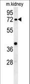 Kelch Like Family Member 6 antibody, LS-C165577, Lifespan Biosciences, Western Blot image 