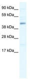 SWI/SNF Related, Matrix Associated, Actin Dependent Regulator Of Chromatin, Subfamily B, Member 1 antibody, TA334777, Origene, Western Blot image 