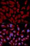 DNA Methyltransferase 3 Alpha antibody, LS-C331867, Lifespan Biosciences, Immunofluorescence image 