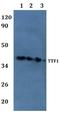 Transcription Termination Factor 1 antibody, A01477, Boster Biological Technology, Western Blot image 