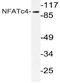 Nuclear factor of activated T-cells, cytoplasmic 4 antibody, AP21053PU-N, Origene, Western Blot image 