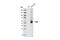 Frizzled Class Receptor 5 antibody, 3795S, Cell Signaling Technology, Western Blot image 