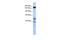 Zinc Finger Protein 335 antibody, A07986, Boster Biological Technology, Western Blot image 