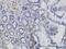 RAS P21 Protein Activator 1 antibody, H00005921-M01, Novus Biologicals, Immunohistochemistry paraffin image 