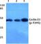 Cyclin E1 antibody, PA5-36636, Invitrogen Antibodies, Western Blot image 