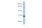 Fibronectin Type III Domain Containing 11 antibody, A16501, Boster Biological Technology, Western Blot image 