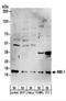 Prefoldin Subunit 5 antibody, NBP2-22337, Novus Biologicals, Western Blot image 