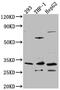 Catechol-O-Methyltransferase antibody, CSB-RA909081A0HU, Cusabio, Western Blot image 
