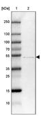 Zinc Finger DHHC-Type Containing 1 antibody, PA5-60015, Invitrogen Antibodies, Western Blot image 