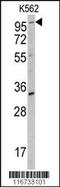 Receptor Tyrosine Kinase Like Orphan Receptor 2 antibody, 63-131, ProSci, Western Blot image 