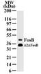 FosB Proto-Oncogene, AP-1 Transcription Factor Subunit antibody, MA1-41121, Invitrogen Antibodies, Western Blot image 