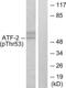 Activating Transcription Factor 2 antibody, LS-C117297, Lifespan Biosciences, Western Blot image 