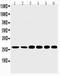 Sonic hedgehog protein antibody, PA1072-1, Boster Biological Technology, Western Blot image 
