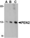 Presenilin Enhancer, Gamma-Secretase Subunit antibody, MBS150886, MyBioSource, Western Blot image 
