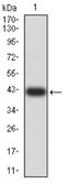 Beta-1,3-Glucuronyltransferase 1 antibody, NBP2-61709, Novus Biologicals, Western Blot image 