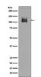 Lysosomal Associated Membrane Protein 2 antibody, M01573, Boster Biological Technology, Western Blot image 