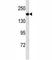 Angiotensin I Converting Enzyme antibody, F53690-0.1ML, NSJ Bioreagents, Western Blot image 