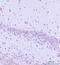 Threonyl-TRNA Synthetase 2, Mitochondrial antibody, A12437, Boster Biological Technology, Immunohistochemistry paraffin image 