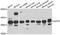 Regulation Of Nuclear Pre-MRNA Domain Containing 1B antibody, A07903, Boster Biological Technology, Western Blot image 