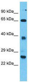 Tetratricopeptide Repeat Domain 26 antibody, TA330805, Origene, Western Blot image 