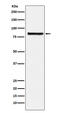 Eukaryotic Translation Initiation Factor 2B Subunit Epsilon antibody, M03801, Boster Biological Technology, Western Blot image 