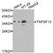 TNF Superfamily Member 13 antibody, A1237, ABclonal Technology, Western Blot image 
