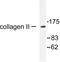 Collagen Type II Alpha 1 Chain antibody, LS-C175971, Lifespan Biosciences, Western Blot image 