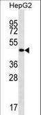 Transmembrane And Coiled-Coil Domain Family 3 antibody, LS-C157207, Lifespan Biosciences, Western Blot image 